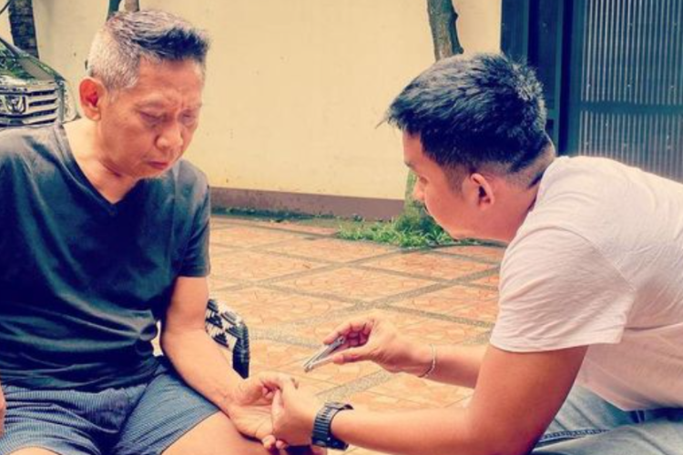 Kenali Gejala Perdarahan Otak yang Dialami Komedian Tukul Arwana, Berawal dari Pusing-Pusing Belaka